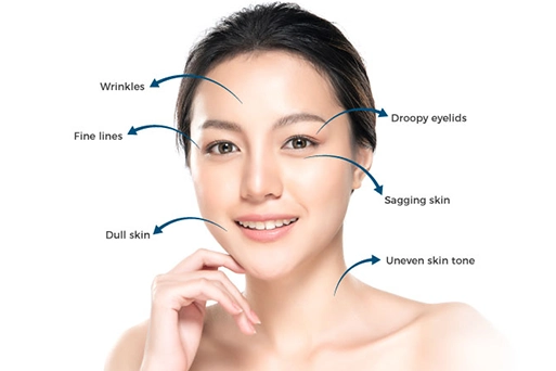 Who is an ideal candidate for HIFU Facelift