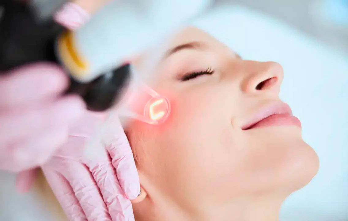 Discover the Power of CO2 Laser - The Gold Standard in Skin Rejuvenation