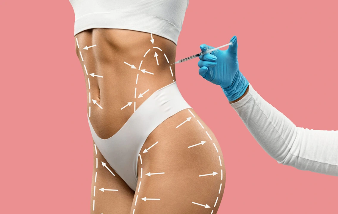 Body Filler in Dubai: Benefits, Treatment, Safety and Results 