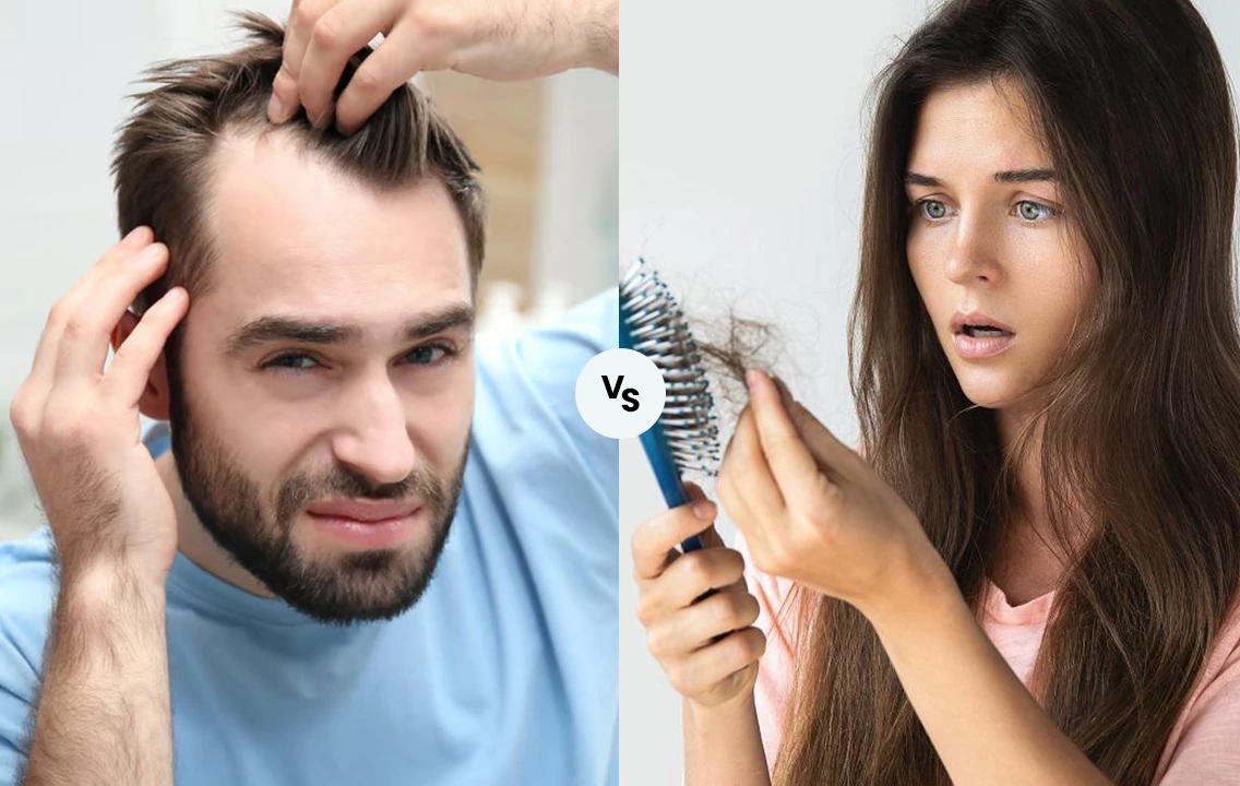 Male vs Female Hair Loss: Causes, Patterns and Treatment Options