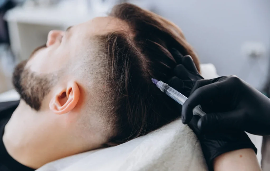 Is P.R.P or Exosome Therapy Better for Skin and Hair?