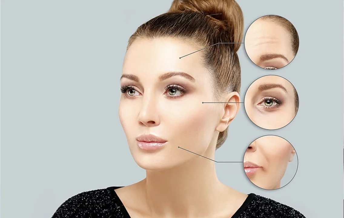 The Ultimate Guide to Botox What You Need to Know